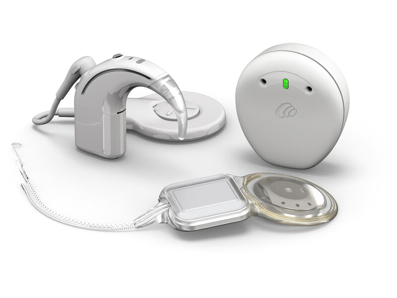 Slimme cochleaire implantaatsysteem: het Cochlear™ Nucleus® Nexa™-systeem
