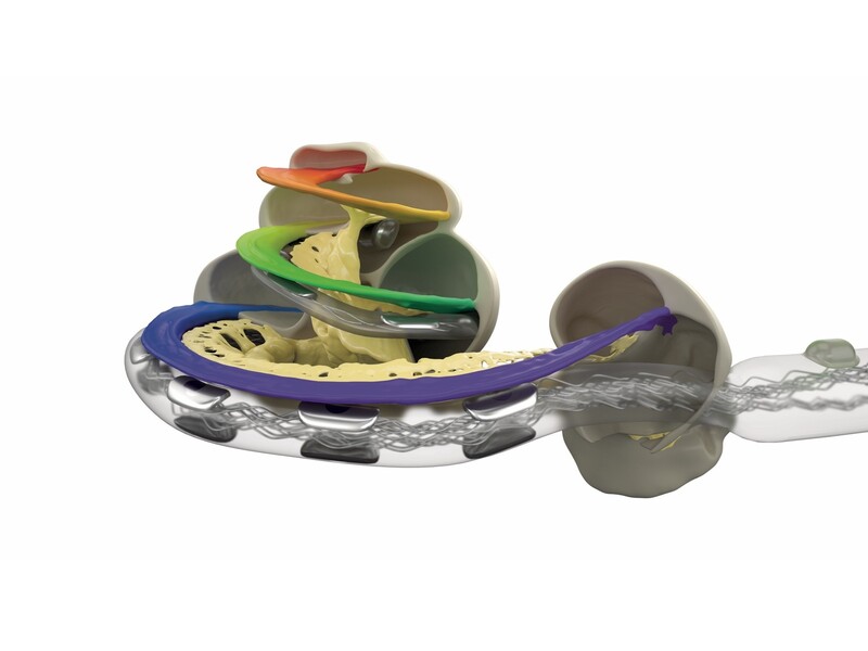 Wat hebben schoenmaten en cochleaire implantaten gemeen?